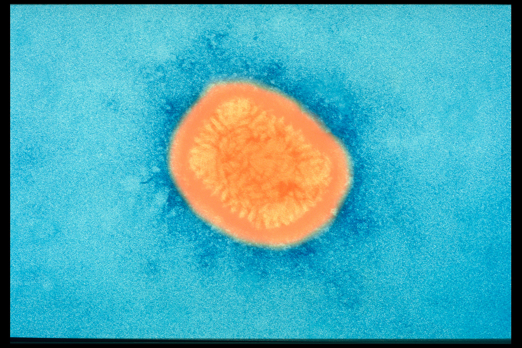 smallpox virus